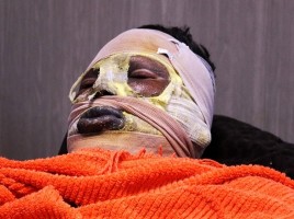 شمار مصدومان حوادث چهارشنبه سوری مازندران به ۱۹ تن رسید
