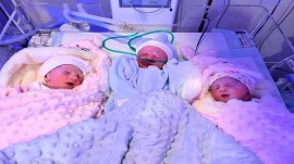 نوزادان سه قلو در تایباد خراسان رضوی متولد شدند