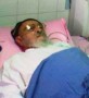 شمال نيوز: ايشان  به دلیل افتادن از پله دچار شکستگی در پای چپ شده و هم‌ اکنون در بخش مراقبت‌های ویژه یکی از بیمارستان‌های تهران بستری است ...