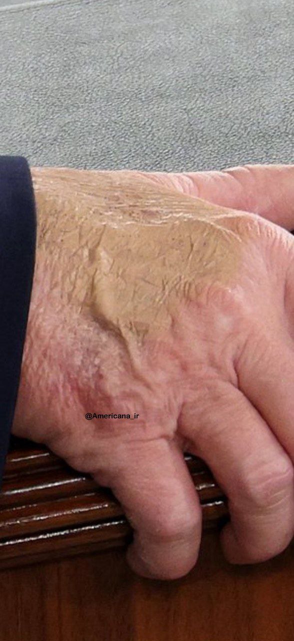 وضعیت دست ترامپ در سخنرانی در امروز کنگره