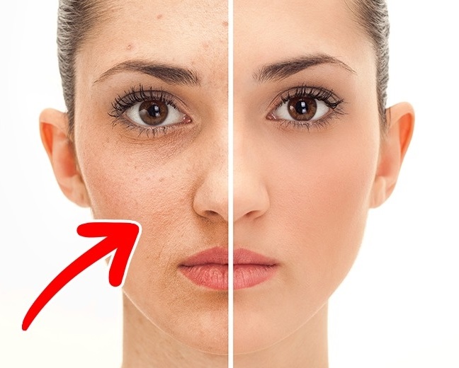 مصرف تخم مرغ