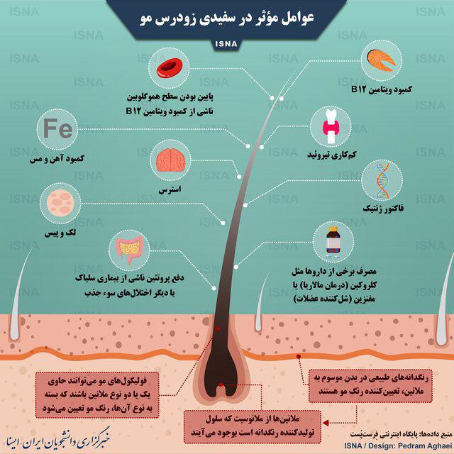 اینفوگرافی/ عوامل مؤثر در سفیدی زودرس مو