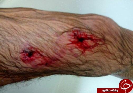 حمله خرس به چوپان در کیاسر + تصاویر