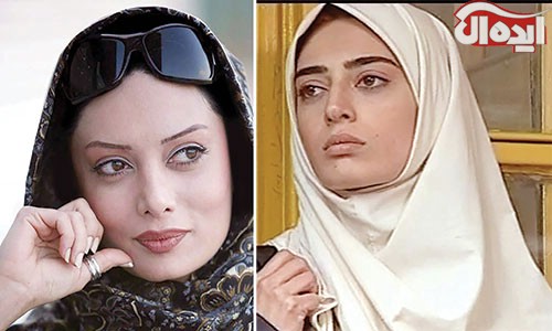 بازیگران ایرانی، قبل از عمل بعد از عمل