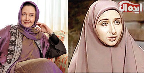 بازیگران ایرانی، قبل از عمل بعد از عمل