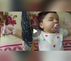 سوختگی دست نوزاد ۴ ماهه بیمارستان رازی قائمشهر چه بود؟ + فیلم ناله مادر