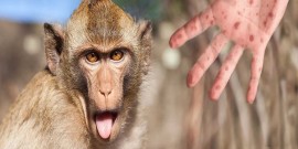 آخرین اطلاعات علمی درباره «آبله میمون»؛ /  بترسیم یا نترسیم؟ 