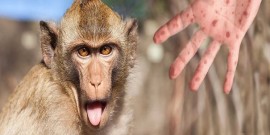 آخرین اطلاعات علمی درباره «آبله میمون»؛ از این ویروس بترسیم یا نترسیم؟ 