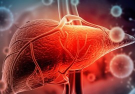 کبد چرب این علایم را در چهره نمایان می‌کند