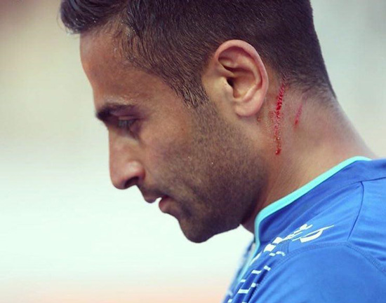 تصویری از گردن خونین بازیکن استقلال در تبریز