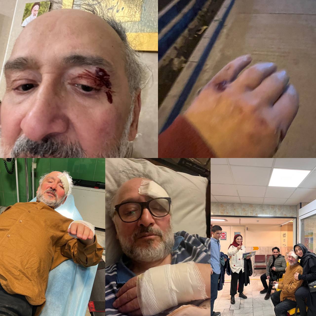 حمله به سیدمحمد ابطحی: 10 بخیه روی ابرو و سینه (عکس)