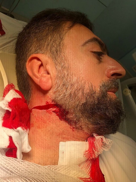 تصاویری از جراحت روحانی که امروز در خیابان رودکی تهران مورد حمله افراد ناشناس قرار گرفت