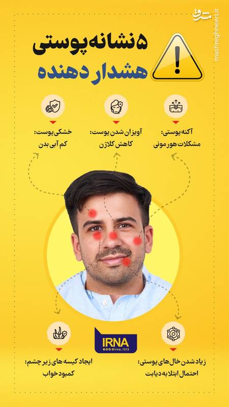 این ۵ نشانه پوستی را جدی بگیرید
