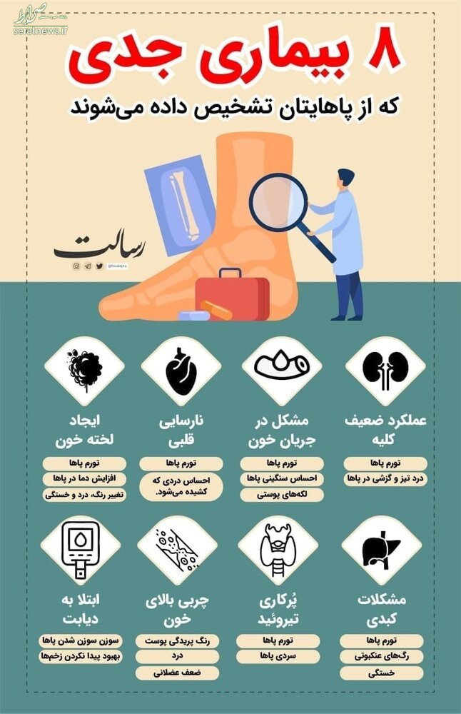 اینفوگرافی/ هشت بیماری جدی که از طریق پا تشخیص داده میشوند اینفوگرافی